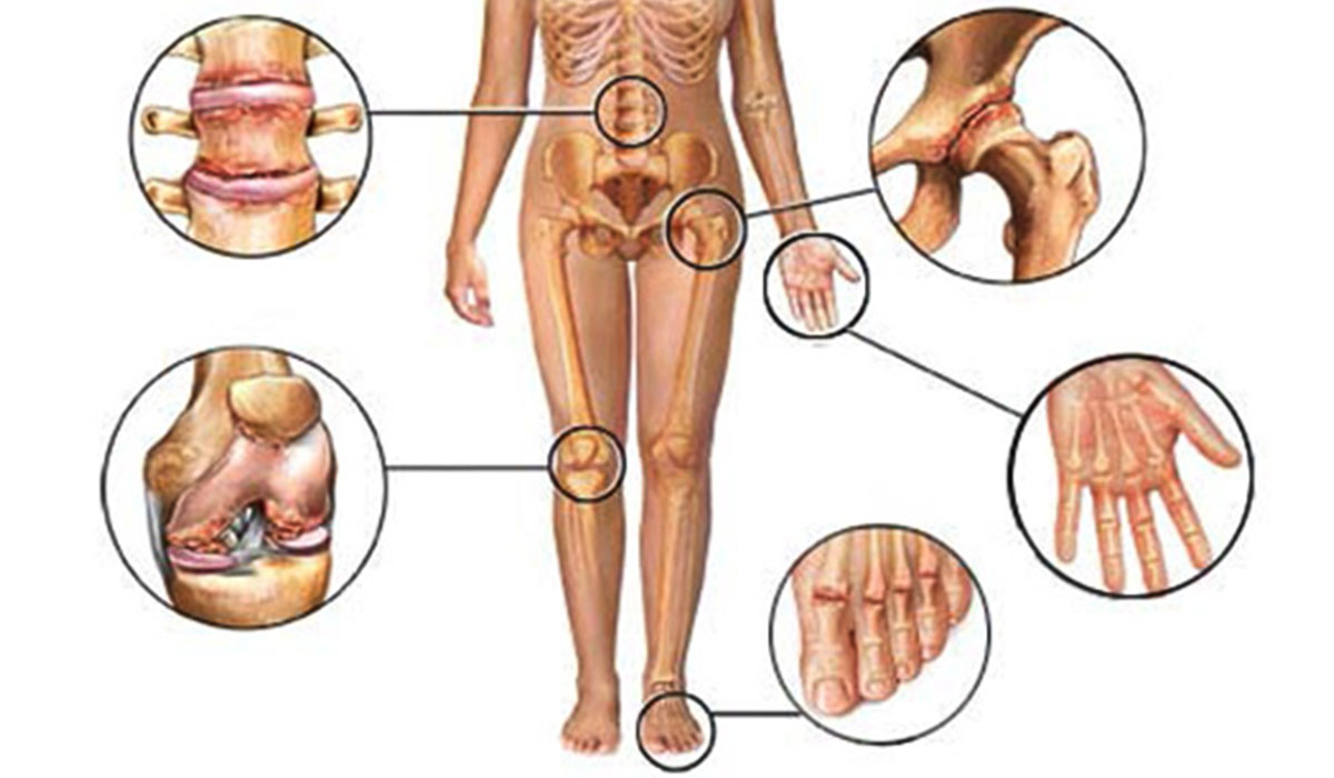 hydrotherapy for Rheumatism