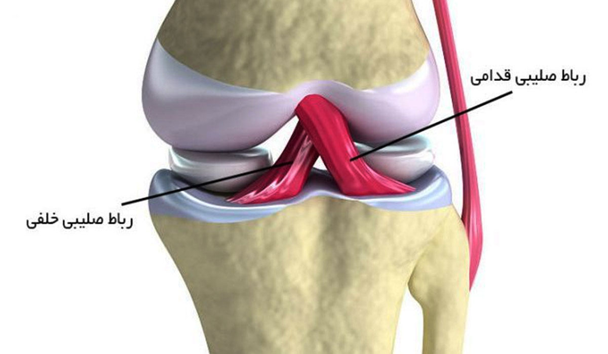 Cruciate ligament treatment2