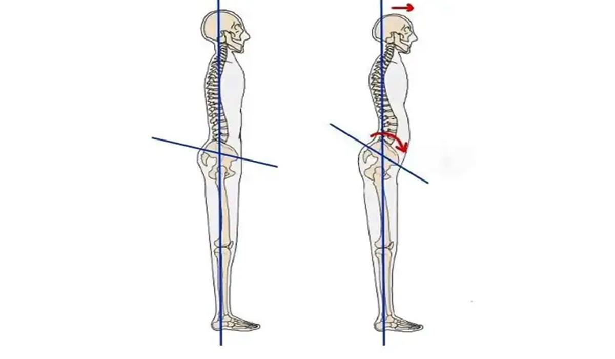 حرکات اصلاحی چرخش لگن