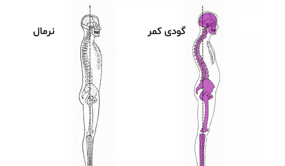 گودی کمر چیست