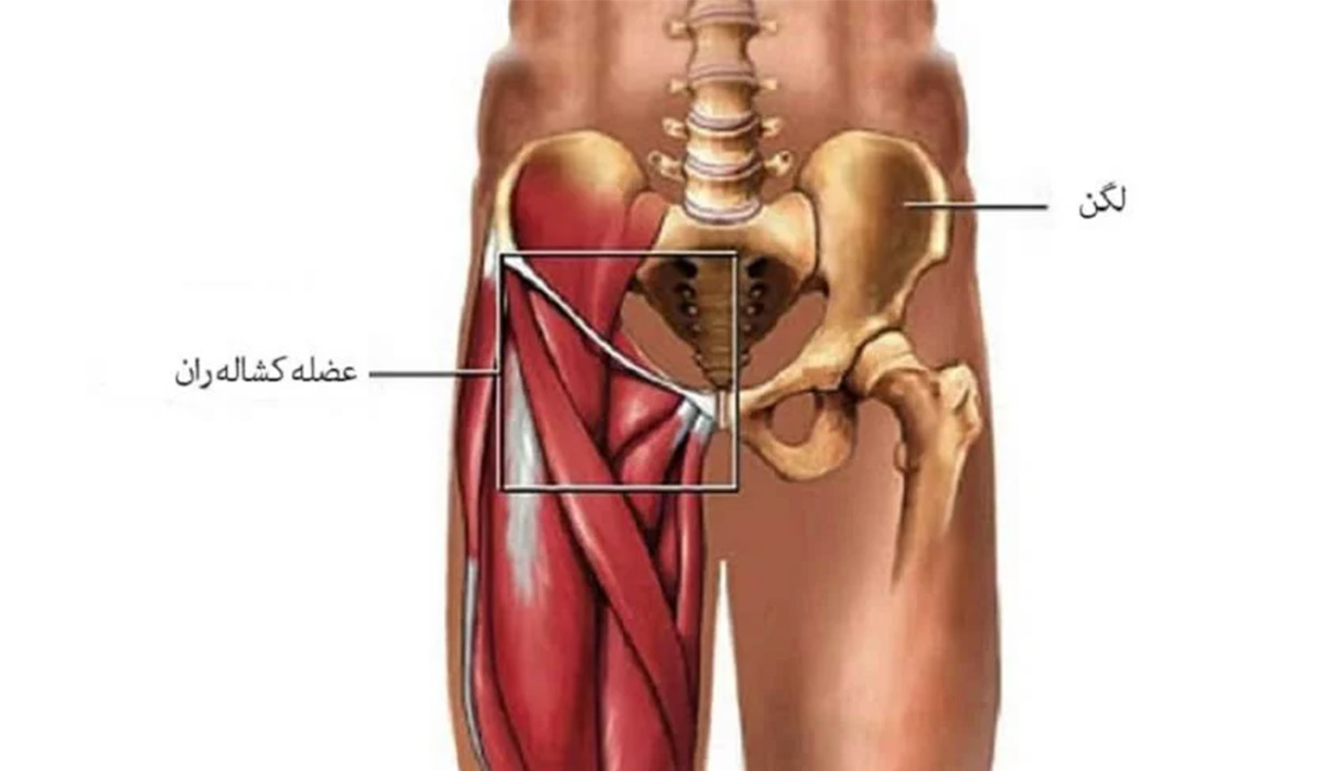 علت درد کشاله ران